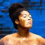 Piperina e vitiligine: possibile soluzione?