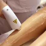 Epilazione laser: un servizio sempre più richiesto nei centri estetici